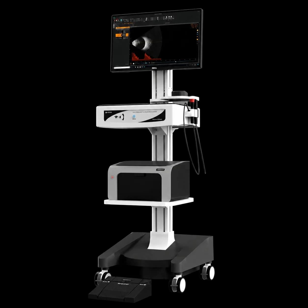Appasamy Ultrasound B-Scan